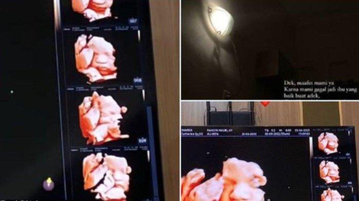 Hasil USG milik orang lain yang digunakan mahasiswi Solo supaya segera dinikahi pria idamannnya.