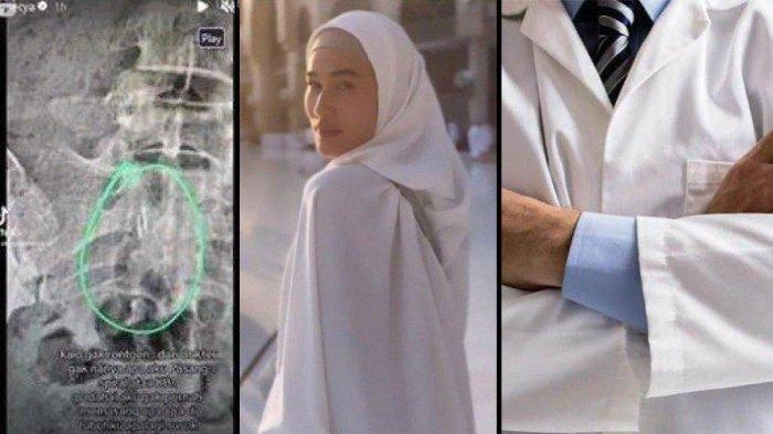 Kasus meninggalnya selebgram Stevie Agnecya masih menyisakan tanda tanya. Pasalnya ibu tiga anak ini pernah mengatakan bahwa dirinya terkena santet sebelum meninggal