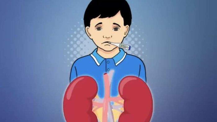 Ilustrasi kasus gagal ginjal akut misterius pada anak