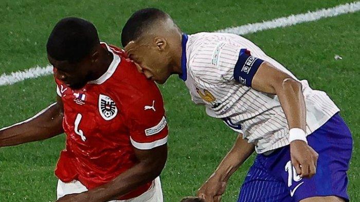 Penyerang Timnas Perancis Kylian Mbappe menderita cedera hidung serius setelah mukanya bertabrakan dengan bahu bek Austria, Kevin Danso pada laga Austria vs Perancis pada Senin (17/6/2024) atau Selasa dini hari WIB.
