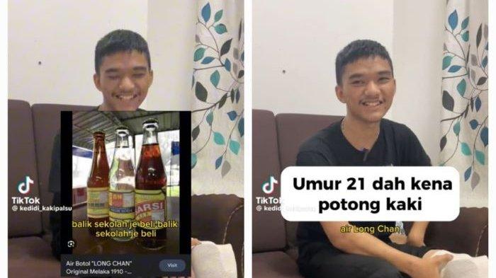 Mahathir, pemuda gemar minum soda yang kini berujung kaki diamputasi.