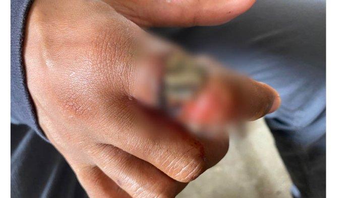 Warga Kroya yakni Arif Subekti (36) pada Jumat (7/7/2023) siang mendatangi Pos Damkar Kroya meminta bantuan untuk melepaskan cincin di jari telunjuknya.
