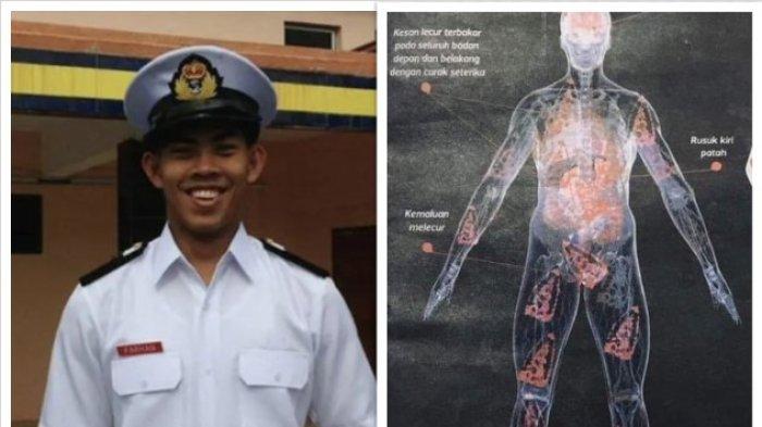 Zulfarhan siswa taruna yang tewas disetrika oleh rekan sesama tarunanya.

