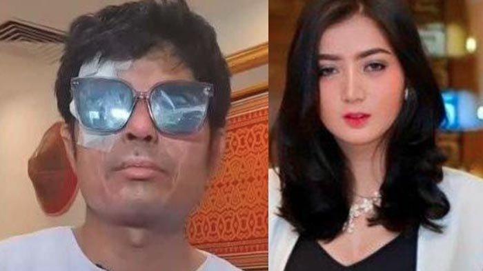 Agus Salim Bisa Dapat Donasi Rp 1,3 M Lagi Jika Mau Berobat, Pratiwi Noviyanthi: Stop Jelekkan Saya