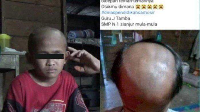 Alasan Guru di Samosir Botaki Siswa dengan Model Tak Wajar, Ngaku Sudah Nasihati, Ortu Kini Maafkan