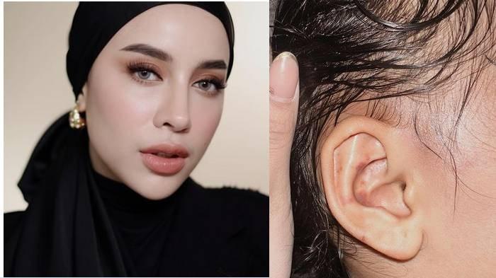 Beredar foto diduga anak dari Aghnia dianiaya oleh suster atau pengasuhnya.