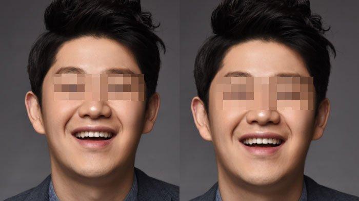 Tak punya keluarga, jenazah Choi Sung Bong tak ada yang jemput di rumah sakit.