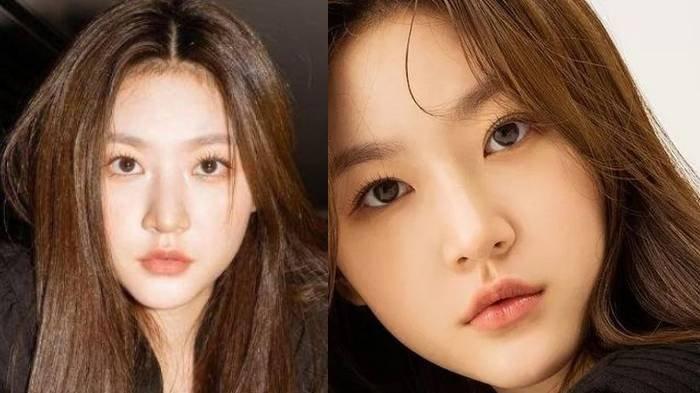 SOSOK LEE JIN HO - Aktris Kim Sae Ron ditemukan meninggal dunia di rumahnya, Minggu (16/2/2025). Diduga penyebab meninggalnya KSR karena peran Lee Jin Ho.