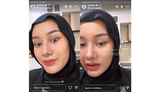 Mengalami kalazion, Dinda Hauw menunjukkan perbedaan area bekas sakit mata yang dialaminya beberapa waktu lalu.