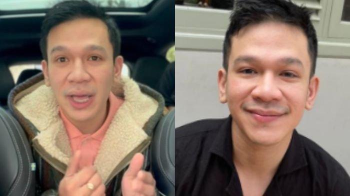 Jordi Onsu, adik Ruben Onsu ungkap mengalami kecelakaan mobil di Tol Cipali. 