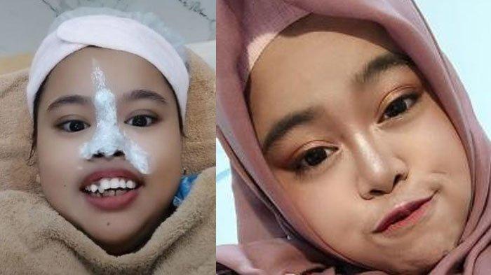 Kekeyi yang sekarang sudah glowing dan sudah berubah secara fisik