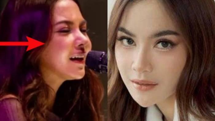 Kolase foto Mahalini yang dinilai tampilan berubah seusai oplas.