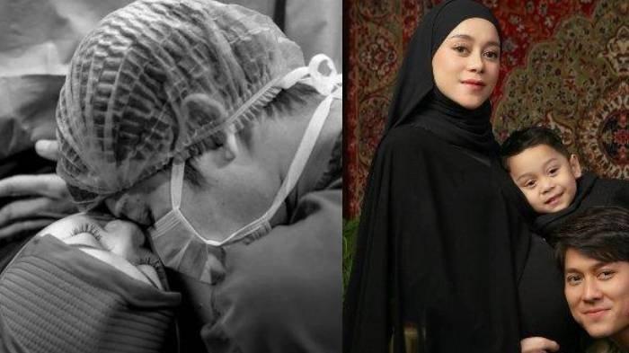 Tangkapan layar unggahan Rizky Billar di akun Instagram @rizkybillar pada Selasa (28/1/2025). Momen saat Lesti Kejora melahirkan, Rizky Billar turut mendampingi di ruang operasi.