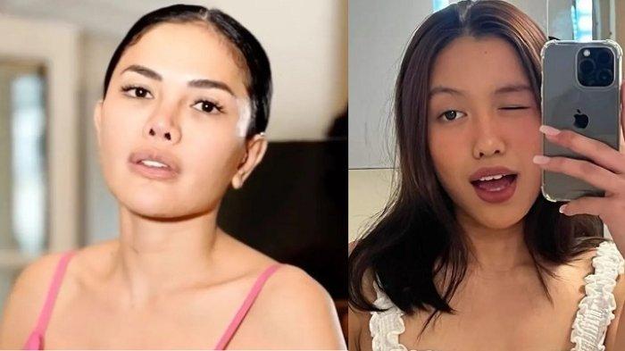 Lolly lewat live Instagram-nya mengisyaratkan ingin berdamai dengan sang ibu.
