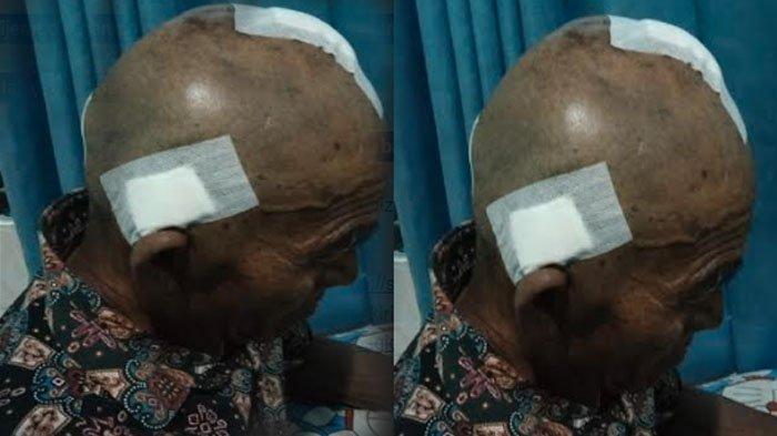 Matrawi, korban pembacokan setelah luka bacok dikepalanya ditangani tim medis.