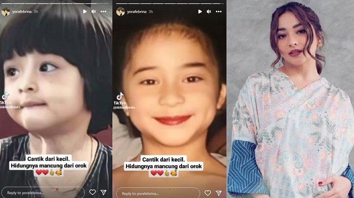 Nikita Willy menuai banyak pujian saat foto-foto transformasinya sedari kecil hingga dewasa.