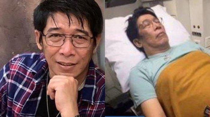 Liburan rayakan ulang tahun ke-63, pelawak kondang Parto malah dilarikan ke rumah sakit. Kondisinya dibagikan sang istri.