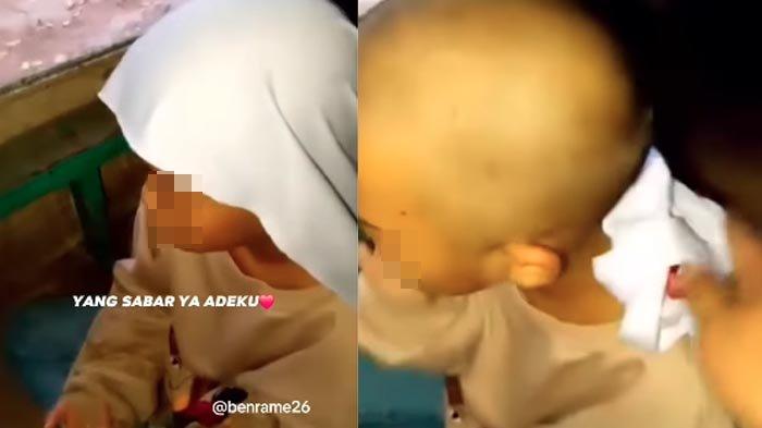 Siswi SD Nangis Dibotaki Gurunya karena Punya Banyak Kutu, Ayah Sakit Hati: Apa Tidak Ada Cara Lain?