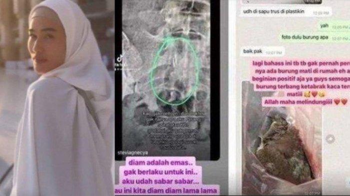 Stevie Agnecya yang meninggal dunia dengan penyakit aneh pada tubuhnya, diperiksa 25 dokter tetap tak jelas.