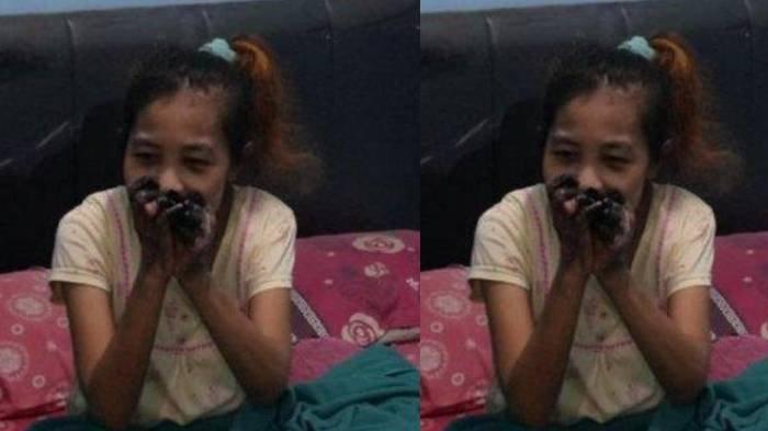 TKW asal Jember, Septia Kurnia Rini (38) mengalami lumpuh setelah diduga menjadi korban malpraktik di Singapura.