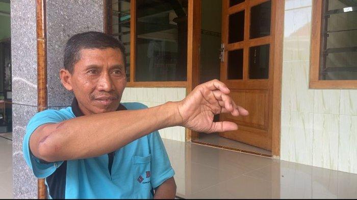 Takmir Masjid Goa Hiro Ponorogo, Nur Rosyid menunjukkan lukanya saat gagalkan pencurian kotak amal