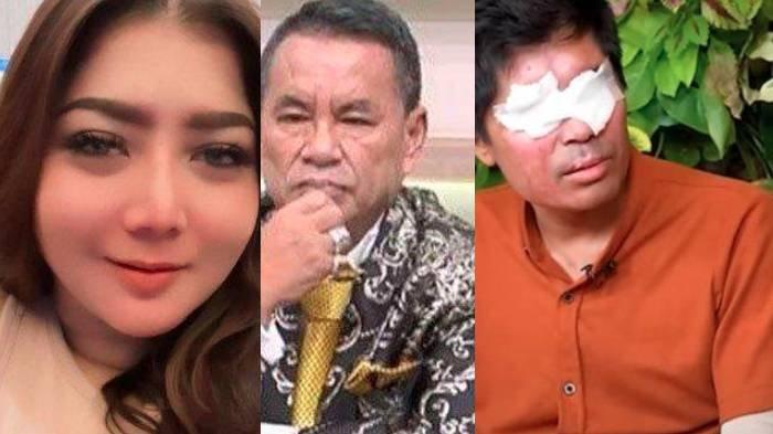 YouTuber Pratiwi Noviyanthi, Hotman Paris, dan Agus Salim korban penyiraman air keras