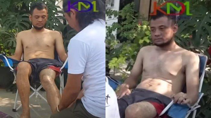 Terungkap Kebiasaan Makan Panji Petualang Pemicu Sakitnya, Tangan Kini Mengecil Sebelah