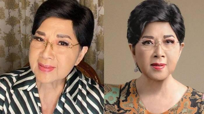 PENYANYI SENIOR MENINGGAL - Titiek Puspa mengalami pecah pembuluh darah. Kondisi ini bisa menjadi penyebab stroke yang gejalanya meliputi sakit kepala parah dan hilang kesadaran.