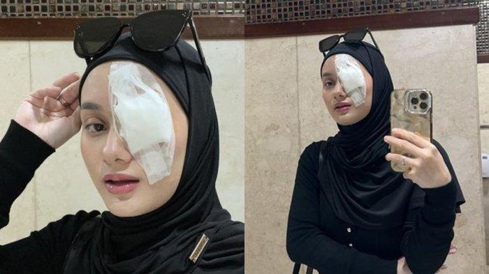 Unggahan Dinda Hauw, yang memperlihatkan bagian matanya dibalut perban.


Artikel ini telah tayang di Sripoku.com dengan judul Mata Dibalut Perban, Kondisi Prihatin Dinda Hauw, Dokter Vonis Istri Rey Mbayang Idap Penyakit Ini, https://palembang.tribunnews.com/2024/03/19/mata-dibalut-perban-kondisi-prihatin-dinda-hauw-dokter-vonis-istri-rey-mbayang-idap-penyakit-ini?page=all.