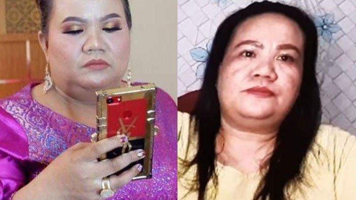 Aty Kodong yang pernah menjadi runner up di ajang dangdut angkatan Lesty Kejora