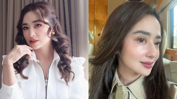 Dewi Perssik ogah operasi plastik sekalipun dibayari. Pasalnya, penyanyi dangdut ini ingin menjaga kenang-kenangan dari mendiang ayah.