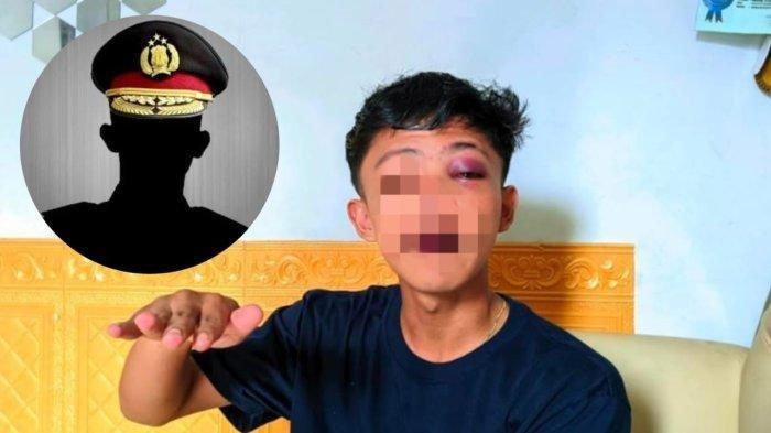 Dianiaya polisi, pelajar di Gorontalo diberi uang tutup mulut Rp50 ribu