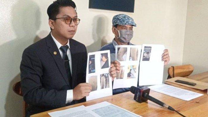 Pemuda dianiaya 30 orang hingga disekap selama tiga bulan karena tak bisa bayar utang Rp100 juta