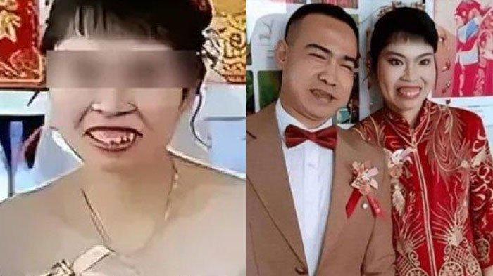Pengantin di China jadi sasaran hujatan netizen karena parasnya