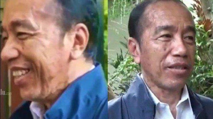PENYAKIT JOKOWI - Penampilan wajah Jokowi yang berubah drastis usai dari Vatikan. Ajudan buka suara menjelaskan kondisi Jokowi, Minggu (22/6/2025).