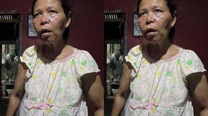 Mak Titin tak terluka setelah ditusuk oleh remaja mabuk berkali-kali.