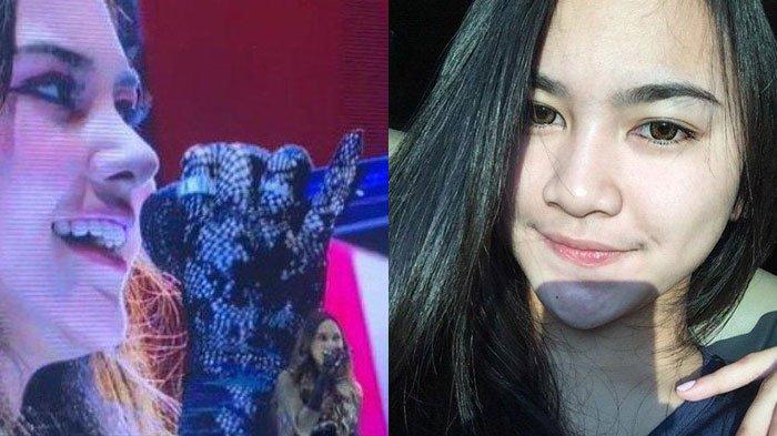 Penyanyi Mahalini menjadi perbincangan setelah wajahnya dinilai berbeda. Istri Rizky Febian itu diduga melakukan operasi plastik bagian hidung.