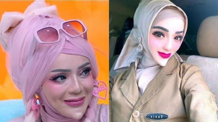 Yuni Jasmine diketahui berprofesi sebagai seorang PNS di Pemerintahan Provinsi Lampung. Ia viral karena berdagu lancip.