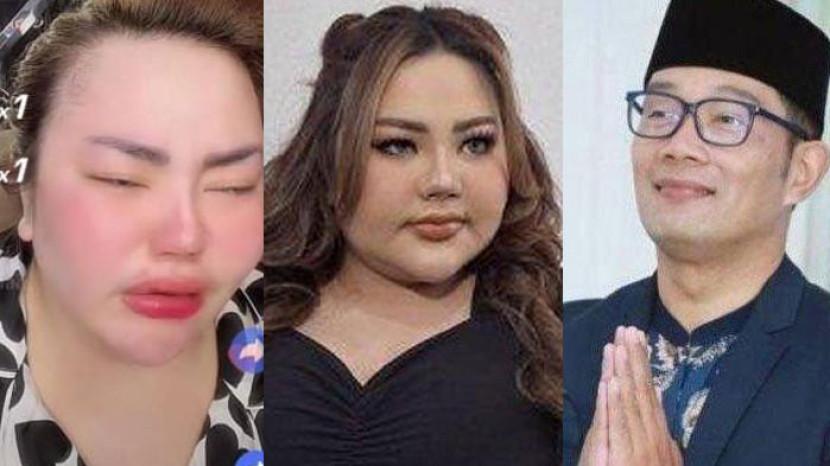 Sosok Lisa Mariana Dulu Ngaku Siap Diborgol Jika Hasil Tes DNA Ridwan Kamil Negatif, Sekarang Nangis