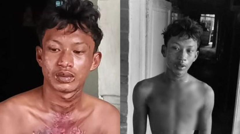 Mau Minta Maaf karena Curi Ubi, Pemuda Nyaris Tewas Dibakar Hidup-hidup ASN Pemkab