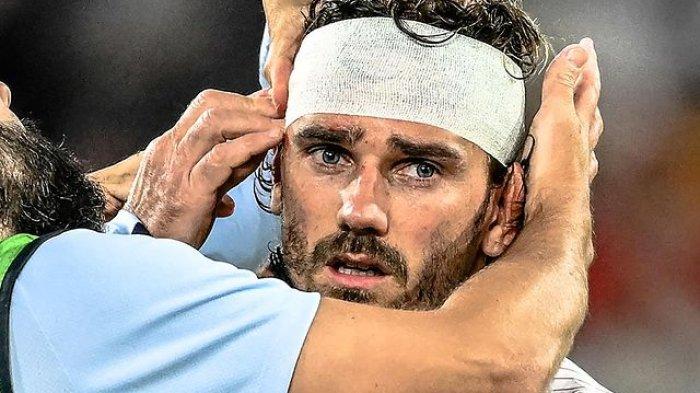 Griezman memakai perbain usai tersungkur menabrak papak iklan di Euro 2024 pada , Selasa (18/6/2024)