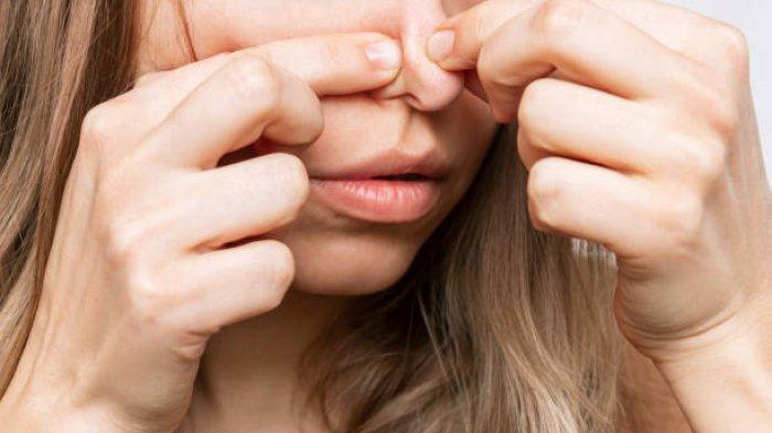 5 Tips Ampuh Menghilangkan Komedo di Hidung