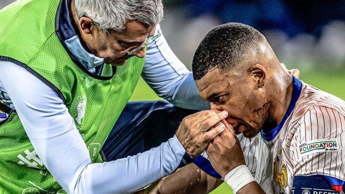 Luka Kylian Mbape pada laga Euro 2024 melawan Austria pada Selasa (18/6/24) dini hari WIB.