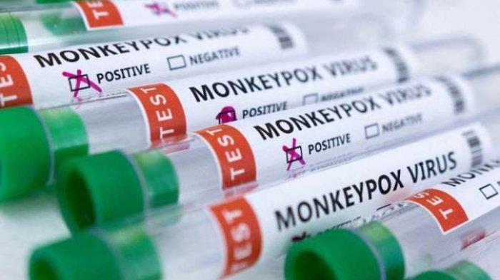 Cara membedakan cacar monyet dan cacar air