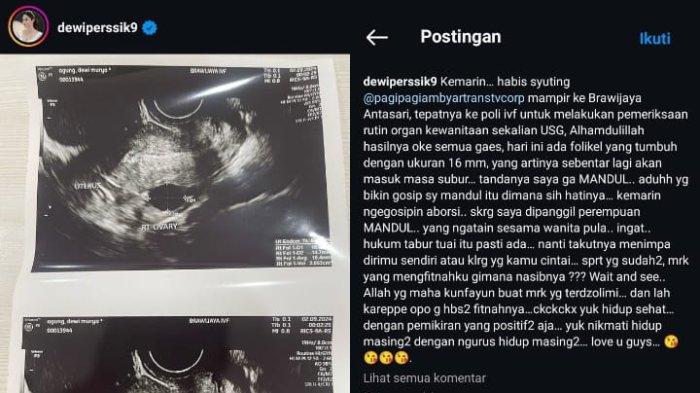 Dewi Perssik unggah foto USG untuk klarifikasi uduhan mandul dari warganet. (Instagram @dewiperssik9)