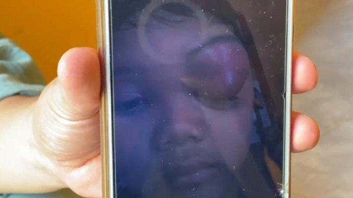 Foto almarhum Muhammad Irwan dengan kondisi mata yang mengalami pembengkangan setelah mengalami pemukulan yang diduga dilakukan salah satu teman sekelasnya.