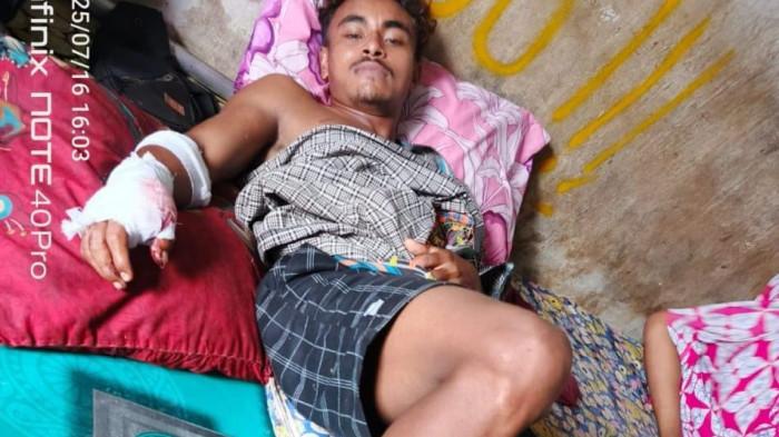 SERANGAN BERUANG - Satu diantara dua korban serangan beruang di Kecamatan Mentaya Hulu, pada Rabu (16/7/2025).