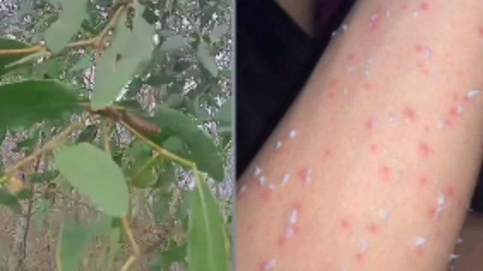Beredar video viral ratusan ulat bulu serang siswa dan warga di Taman Bebaya, Samarinda, Kalimantan Timur.