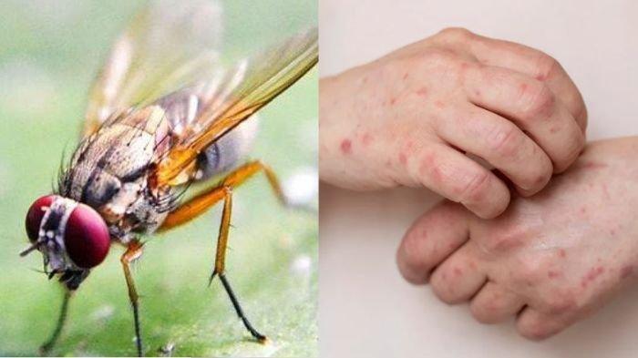 Ilustrasi lalat pasir serangga yang menyerang tentara Israel, bisa menimbulkan penyakit Leishmania.