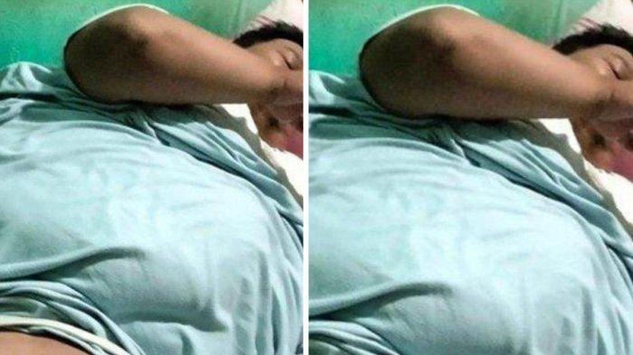 Potret Engky, tukang ojek di Tangerang yang mengalami obesitas dengan berat badan mencapai 200 kilogram.